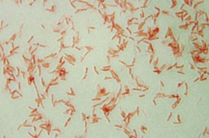 Slide of Aeromonas hydrophila