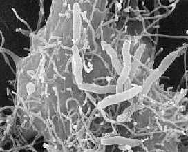 Aeromonas hydrophilia under an electron microscope